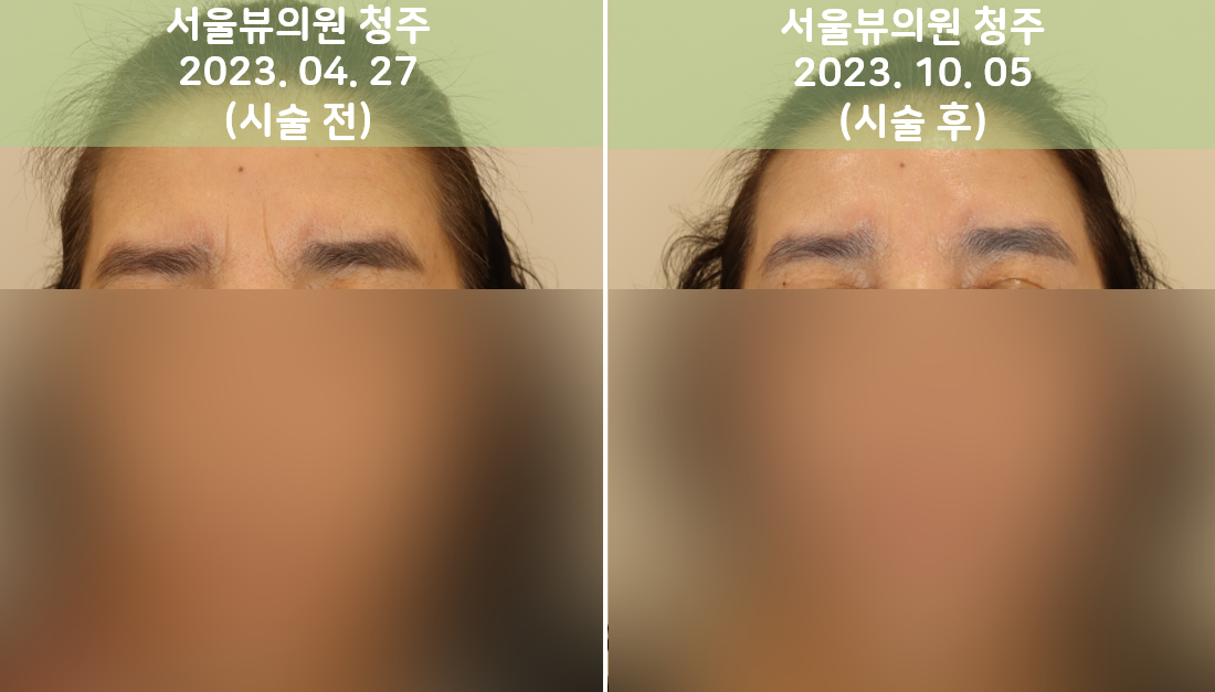joovelook15