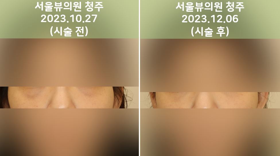 joovelook23