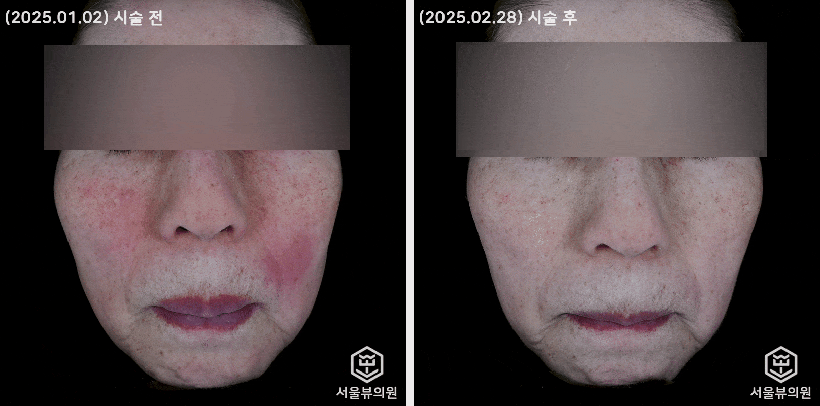 skin1