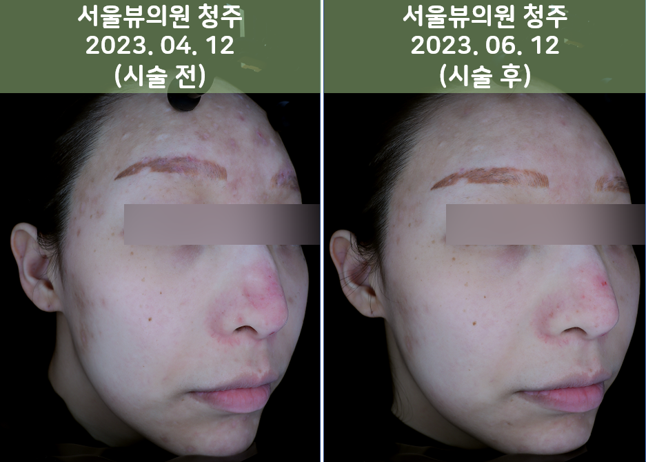 skin10
