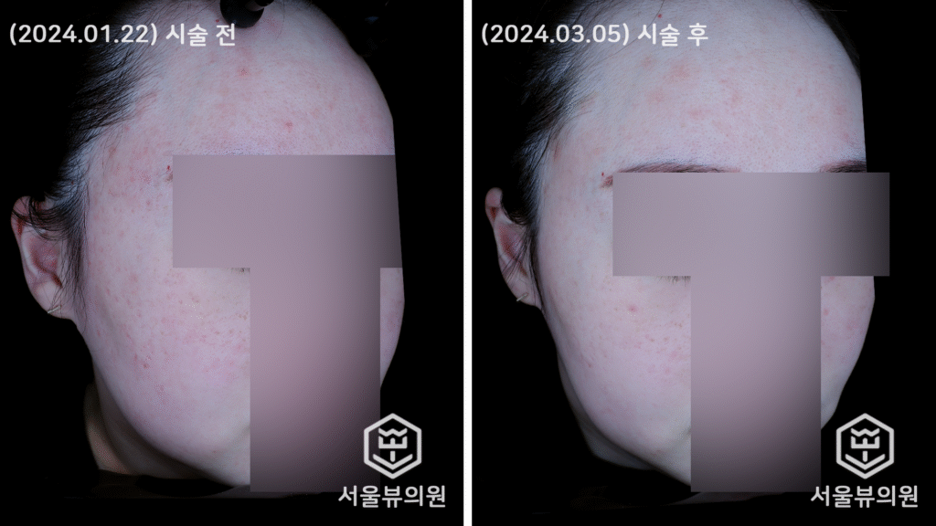 skin17
