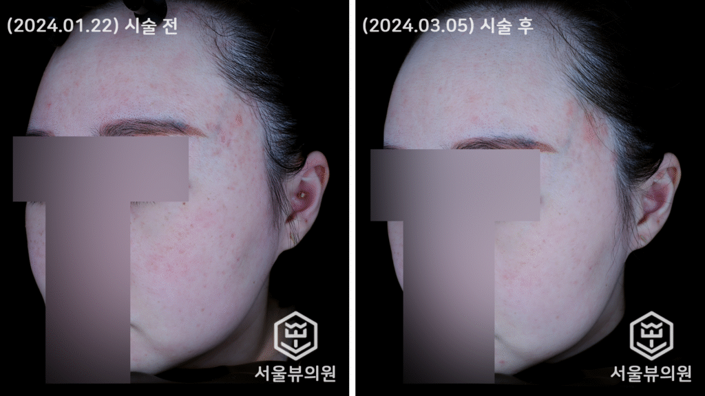 skin16