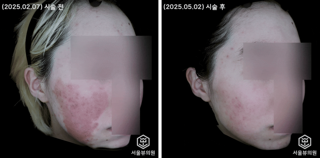 skin2
