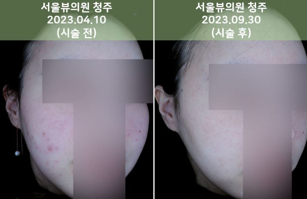 skin7