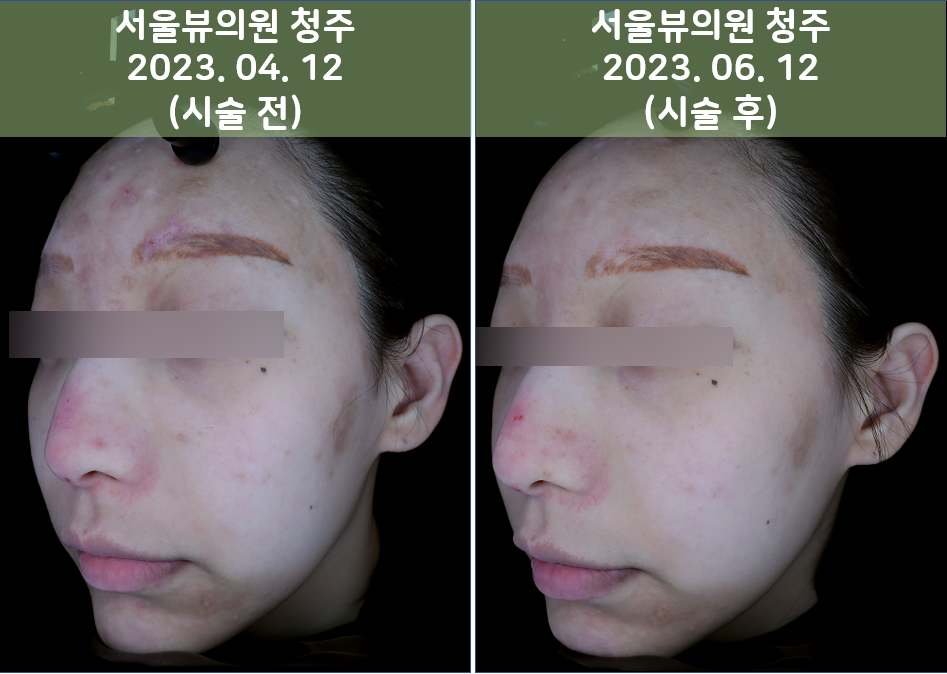 skin8