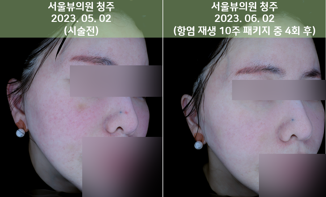 skin9