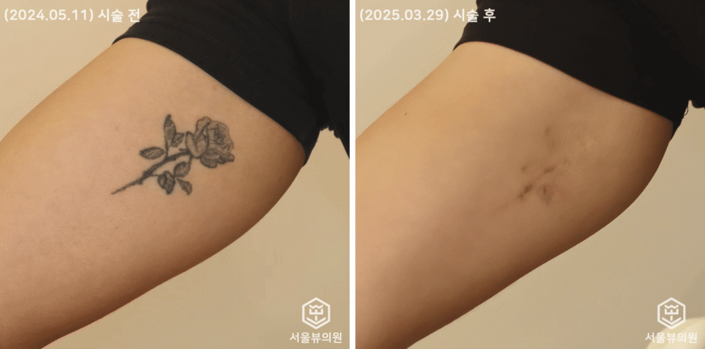 tatoo2