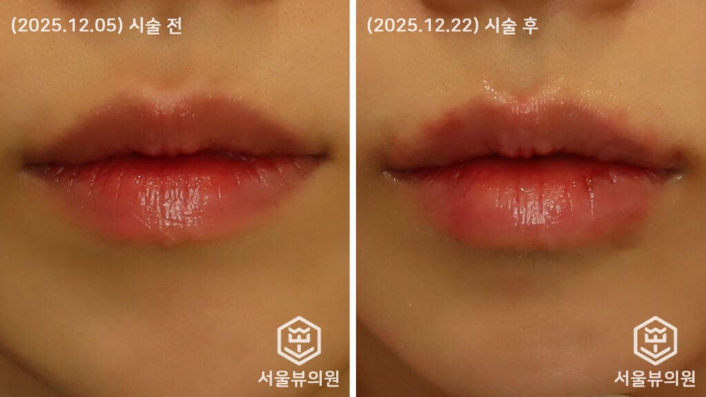 KakaoTalk 20251223 195708068