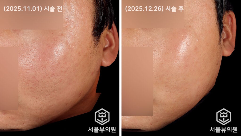 skin101