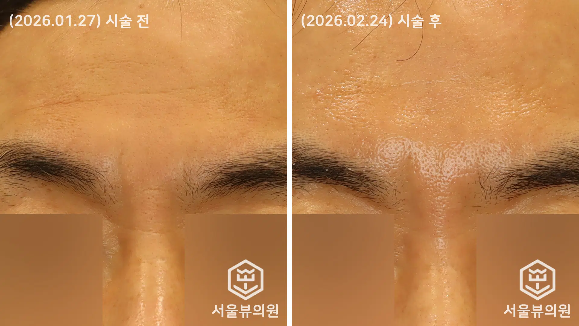 KakaoTalk 20260224 131030981