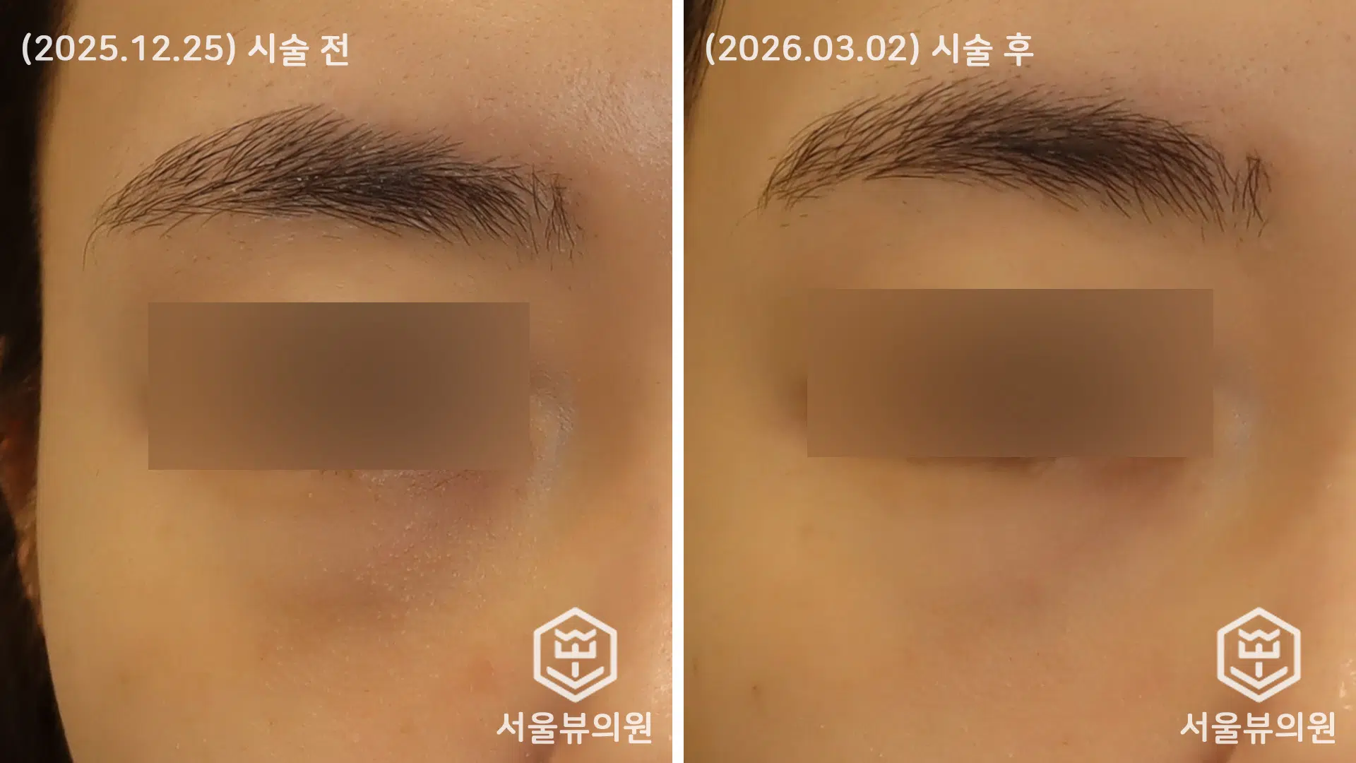 KakaoTalk 20260303 161354260 01
