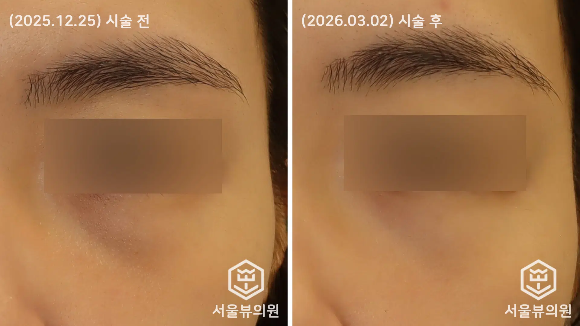 KakaoTalk 20260303 161354260 02
