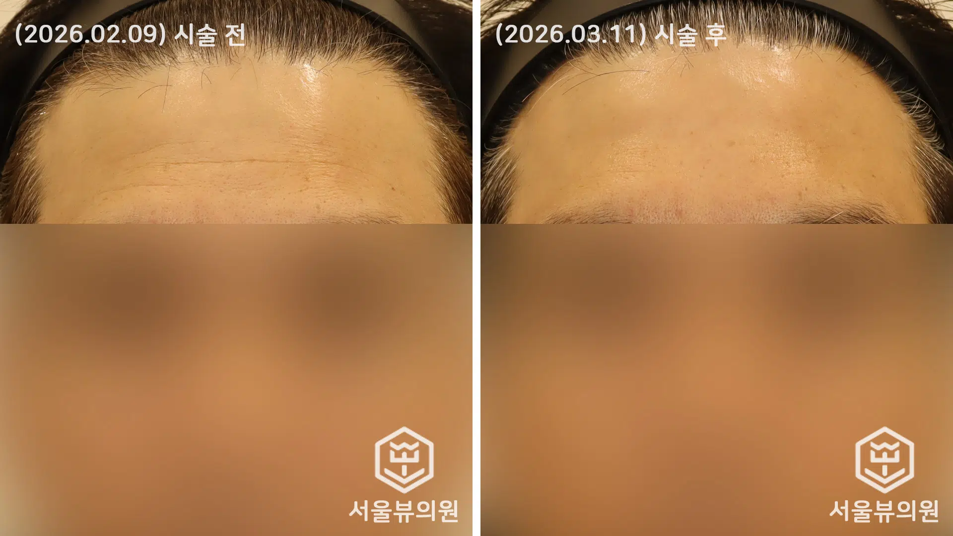 KakaoTalk 20260311 131344274