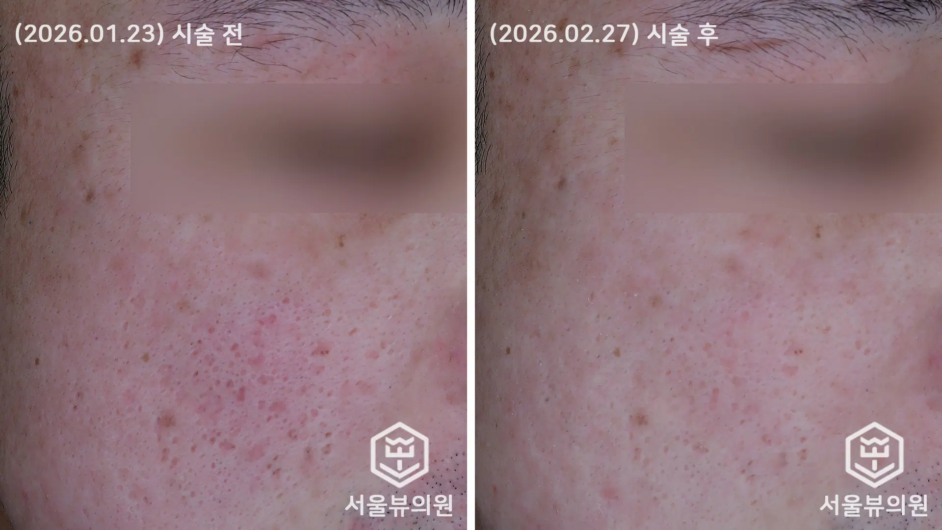 KakaoTalk 20260316 164949876