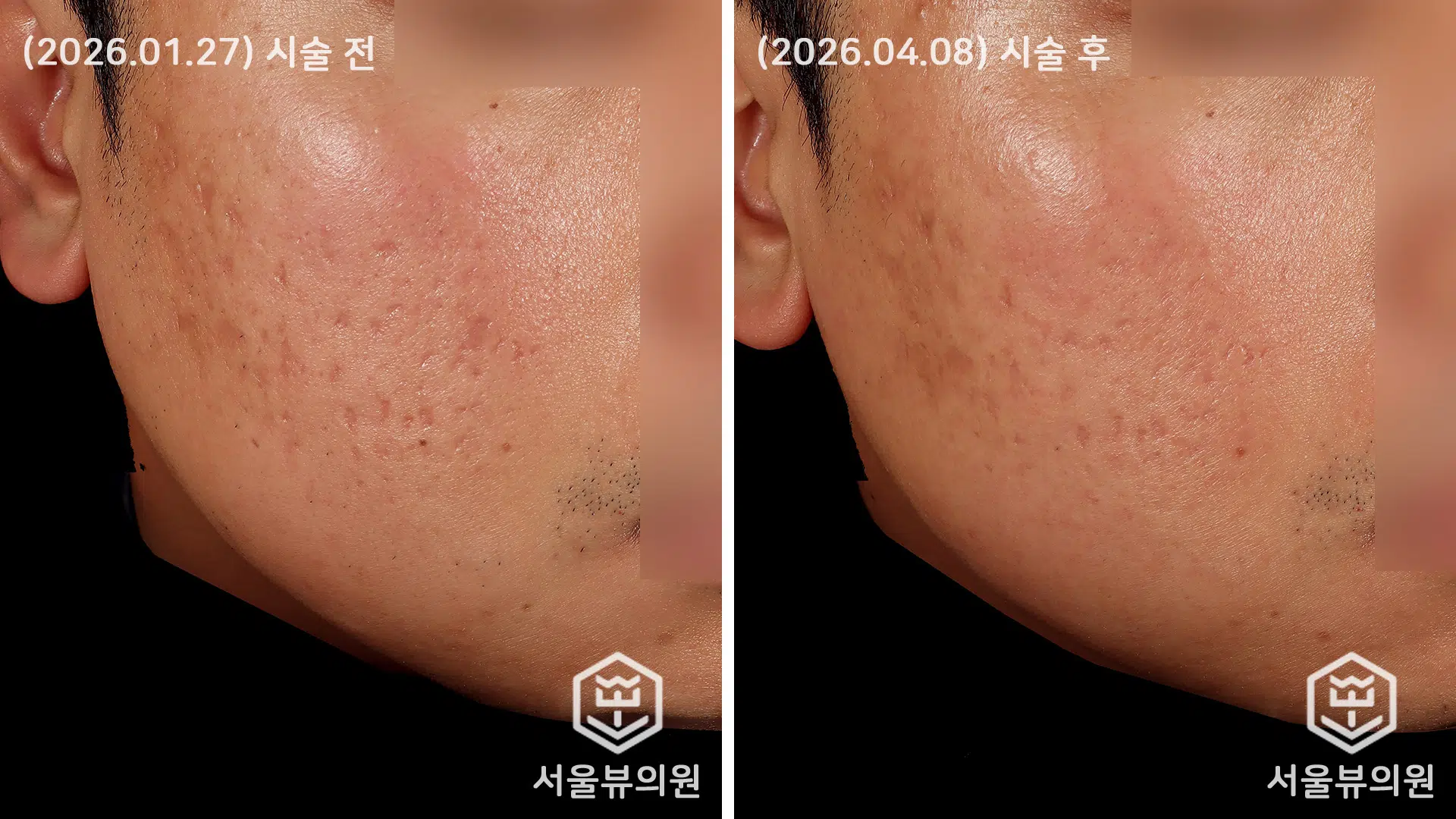 KakaoTalk 20260408 144324885