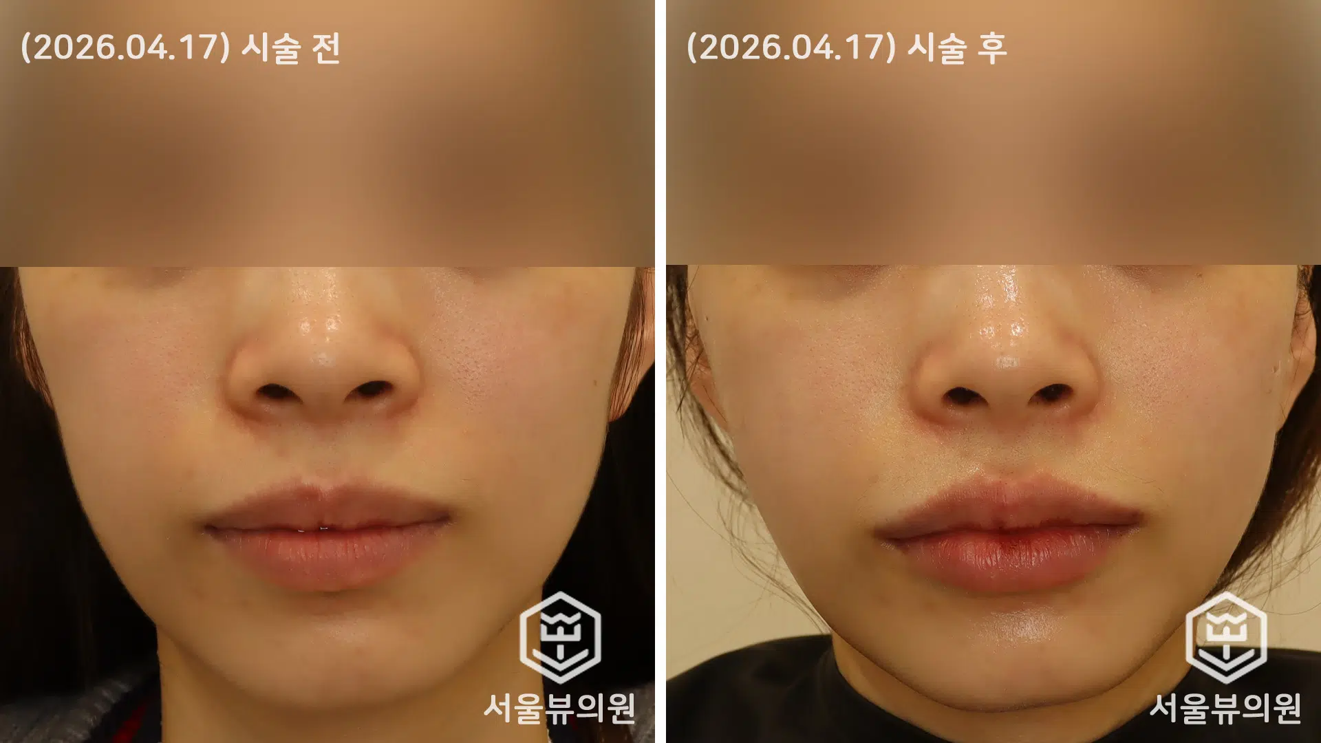 KakaoTalk 20260417 144506736