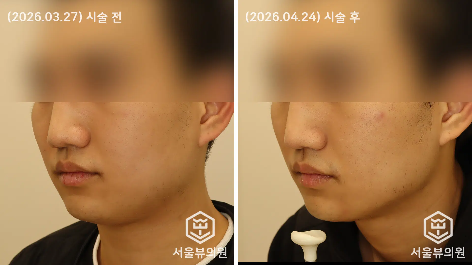 KakaoTalk 20260427 192627993 01