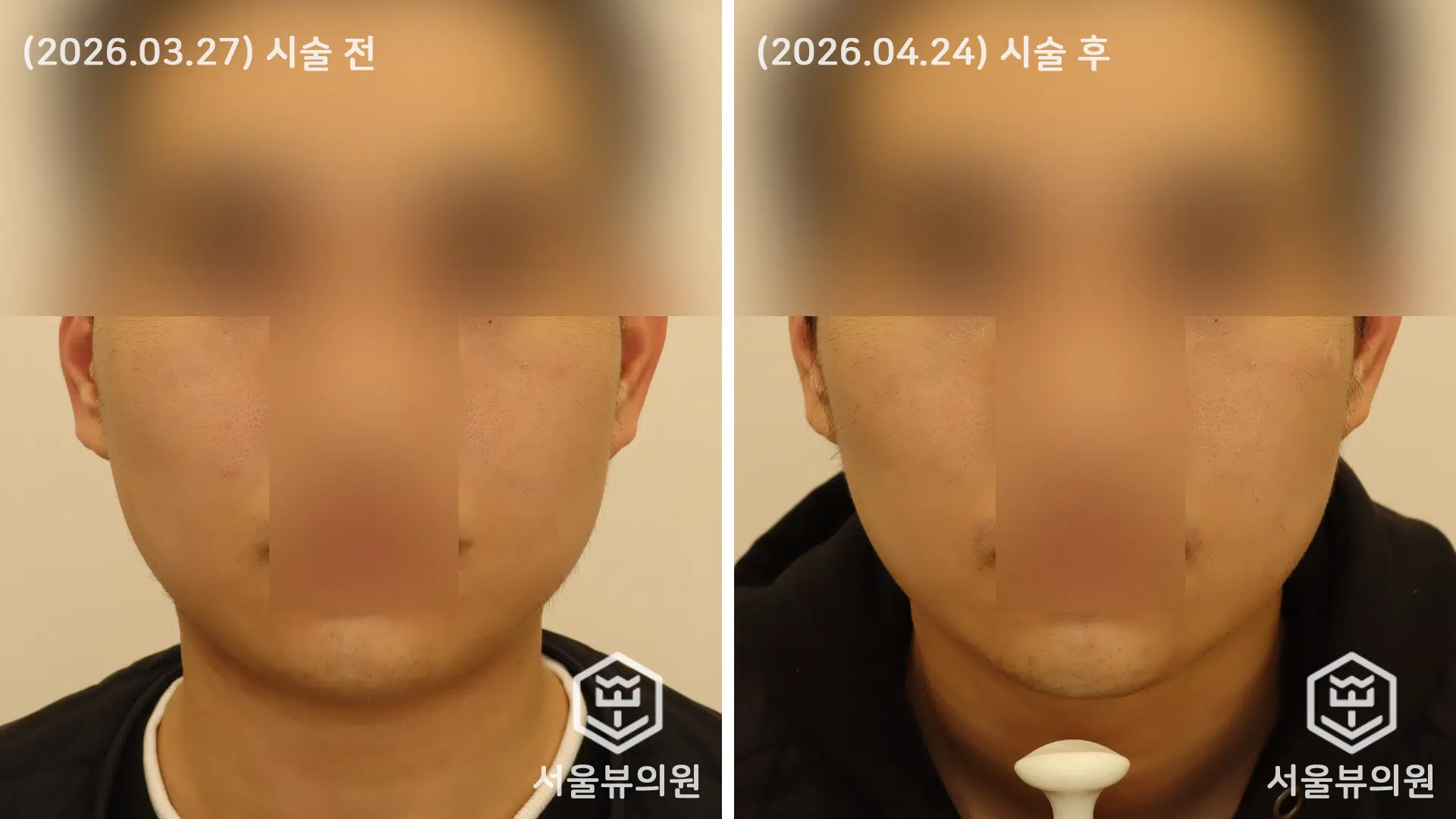 KakaoTalk 20260427 192627993 02