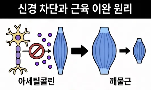 사각턱 보톡스 후 씹을 때 불편한 이유는? 2 사각턱 보톡스 후 씹을 때 불편한 이유는 무엇인가요?