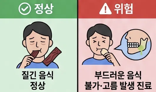 사각턱 보톡스 후 씹을 때 불편한 이유는? 4 정상 반응과 진료가 필요한 신호는 어떻게 구분하나요?